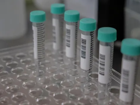 ¿Cuánto dura la cuarentena por COVID-19?