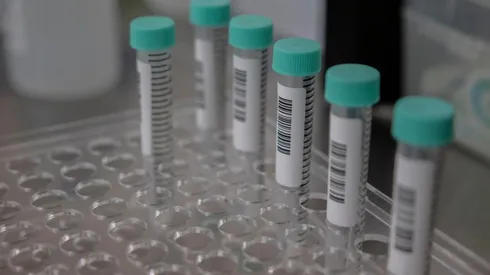 ¿Cuánto dura la cuarentena por COVID-19?