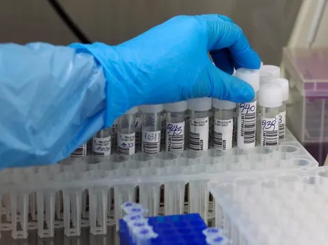 ¿Cuántos casos de covid-19 hay este sábado en Chile?