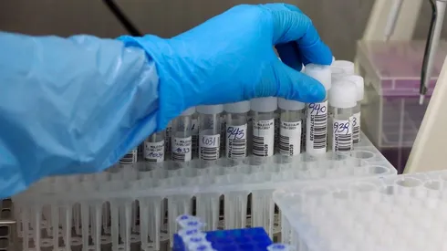 Conoce el detalle de la pandemia en Chile.