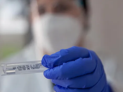 ¿Cuántos casos de Covid-19 hay este viernes 18 de febrero en Chile?