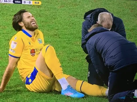 Ben Brereton sale lesionado en paupérrimo empate de Blackburn