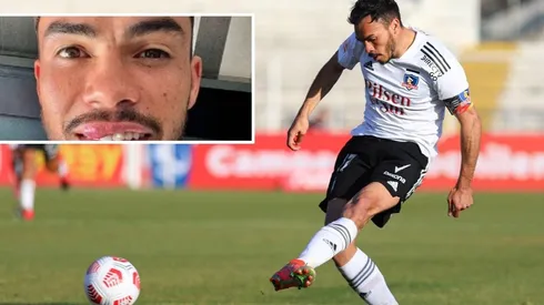 El capitán albo terminó en el dentista tras un choque en entrenamiento.