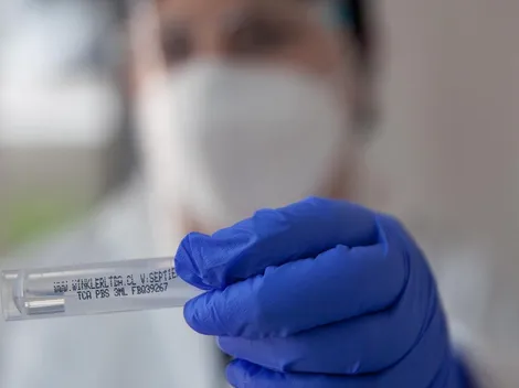 ¿Cuánto dura la cuarentena por Covid positivo en Chile?