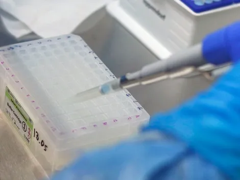 ¿Cuántos días tengo que hacer cuarentena si soy caso confirmado?