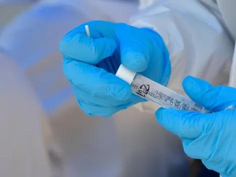 ¿Cuántos casos covid-19 hay este lunes en Chile?