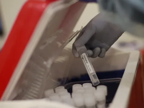 ¿Cuántos casos de covid-19 hay este domingo en Chile?