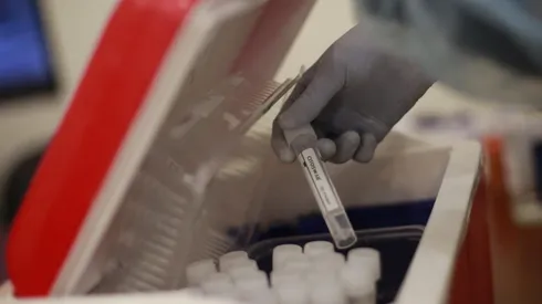 Conoce el detalle de la pandemia en Chile.