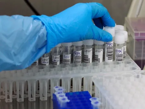 ¿Cuántos casos covid-19 hay este sábado en Chile?