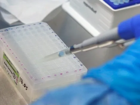 ¿Cuánto dura la cuarentena a casos confirmados de COVID-19?