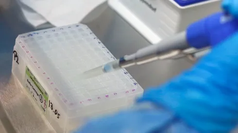 ¿Cuánto dura la cuarentena a casos confirmados de COVID-19?