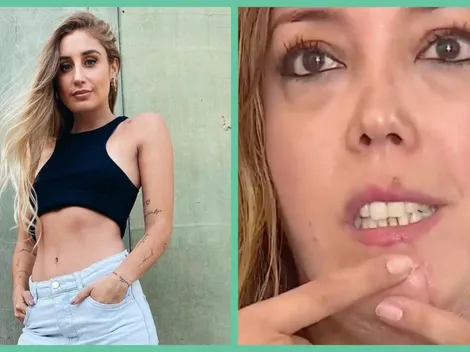 Mujer atacada por perro de Daniela Castro demandará a la ex Masterchef