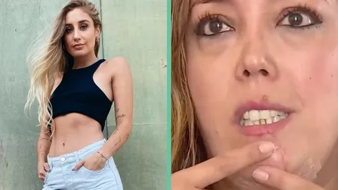 Daniela Castro y Carolina Mujica, la mujer atacada por el perro de la influencer.