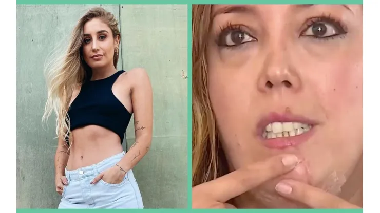 Daniela Castro y Carolina Mujica, la mujer atacada por el perro de la influencer.