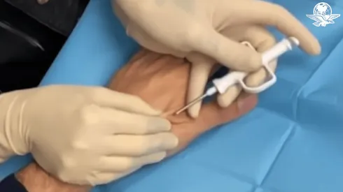 Empresa sueca crea microchip con Pase de Movilidad