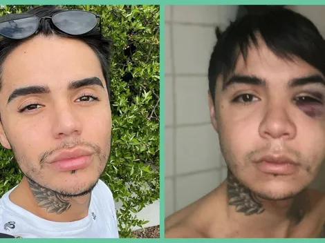 Leo Méndez Jr. saca "municiones" de reserva y responde a la clínica