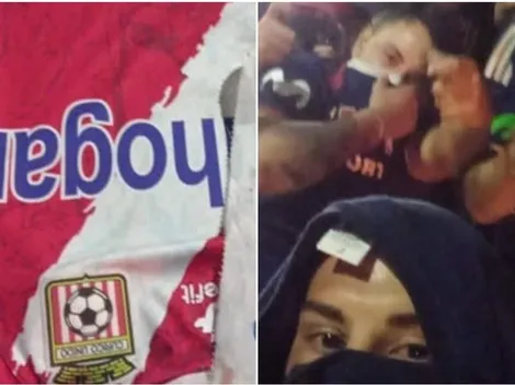 Mujer atacada por hinchas de la U: "Sentí que me iba a morir"