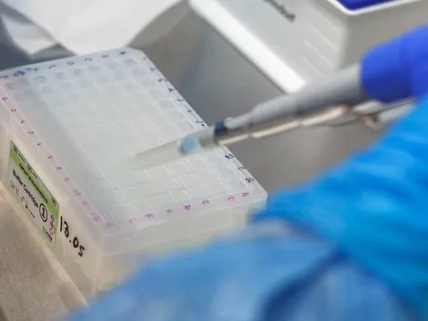 ¿Cuántos casos hay este jueves 25 de noviembre?