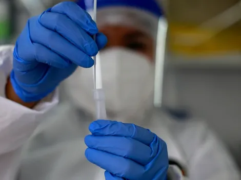 Informe Minsal | ¿Cuántos casos de Covid-19 se registran este martes 26 de octubre?