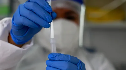 El Ministerio de Salud anunció un alza de casos diarios.