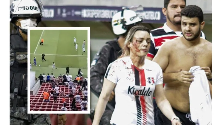 Una directiva del Santa Cruz resultó herida tras invasión de hinchas