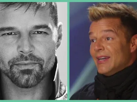 ¿Qué se hizo Ricky Martin en la cara? Ya hay explicación...