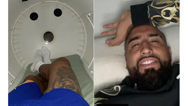 Vidal se recupera de su lesión soñando llegar a eliminatorias con Chile