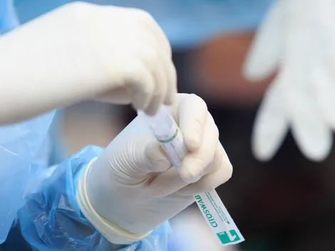 ¿Cuántos casos de Covid-19 hay este sábado 4 de septiembre?