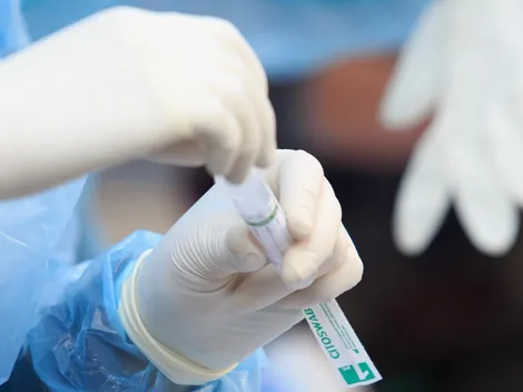 Calendario Vacunación Covid-19 | ¿Quiénes se pueden vacunar este lunes 30 de agosto?