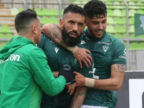 Fernández y críticas a SW: “Nos tiran mierda todas las semanas”