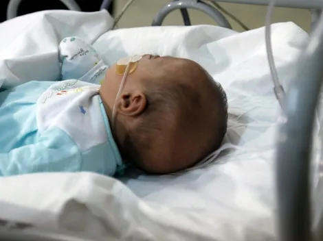 ¿Cuántos casos de virus sincicial hay en Chile?