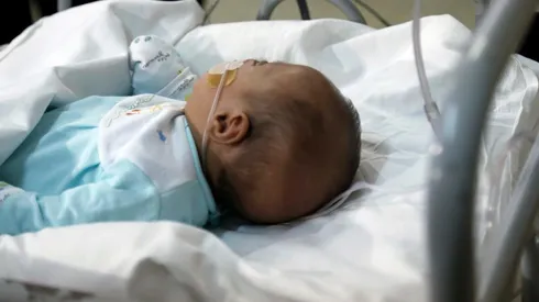 ¿Cuántos casos de virus sincicial hay en Chile?