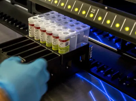 ¿Cuántos casos de Variante Delta hay en Chile?