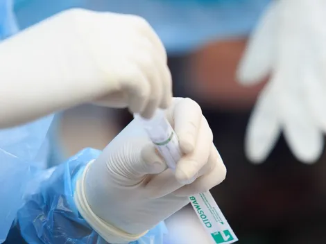 ¿Cuántos casos de Covid hay este viernes 23 de julio?