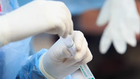 Conoce el detalle de la actualidad de la pandemia