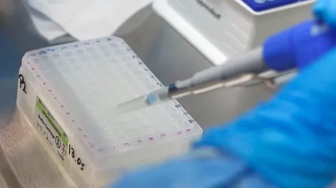 ¿Si tuve Covid me puedo contagiar de nuevo?