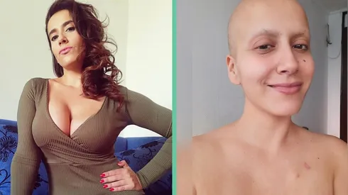 El antes y el después del tratamiento contra el cáncer de Mila Correa, quien ha registrado exhaustivamente el proceso en su Instagram.