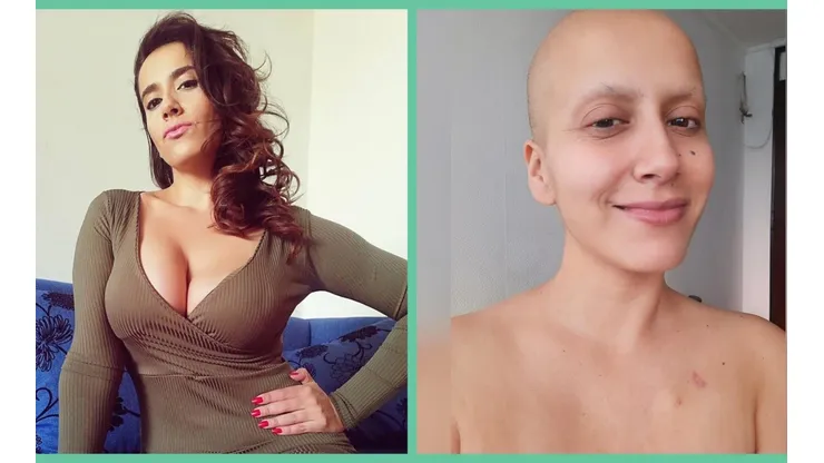 El antes y el después del tratamiento contra el cáncer de Mila Correa, quien ha registrado exhaustivamente el proceso en su Instagram.