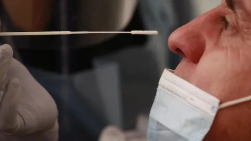 ¿Cuáles son los síntomas de Covid-19?