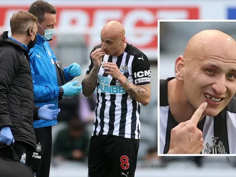 Rudísimo: Jonjo Shelvey perdió un diente y siguió jugando