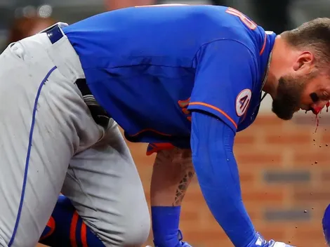 Beisbolista de los Mets recibe pelotazo a 151 km/h en el rostro
