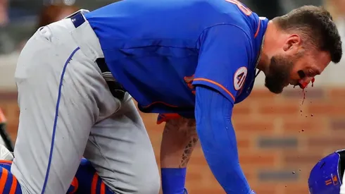 Kevin Pillar sangró notoriamente pero salió por sus medios.