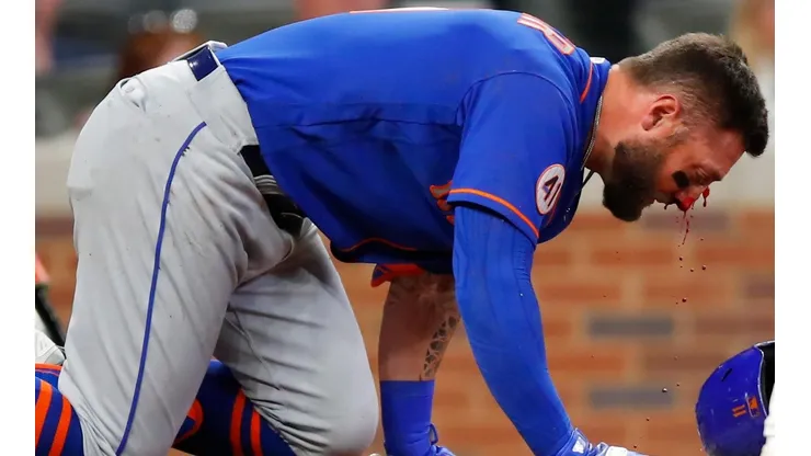 Kevin Pillar sangró notoriamente pero salió por sus medios.