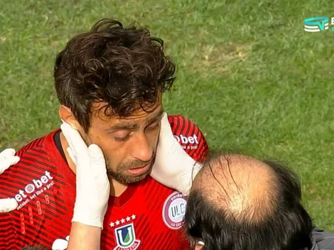 Duro pelotazo deja grogui al Mago Valdivia