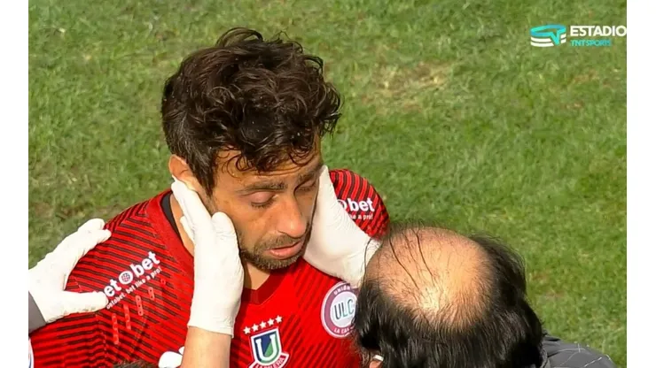El Mago quedó mareado tras el despeje.