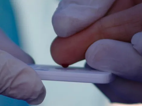 ¿El coronavirus es infección vascular?