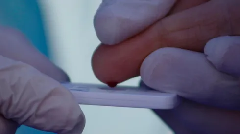 ¿El coronavirus es infección vascular?