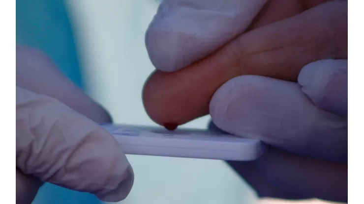 ¿El coronavirus es infección vascular?