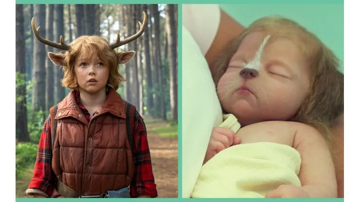 Gus es el protagonista de la historia de Sweet Tooth.