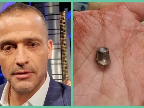 Iván Núñez tras ataque: "Nos dispararon a matar"